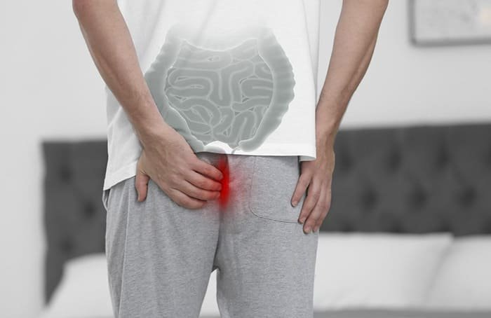 Cirugía de padecimientos ano-rectales